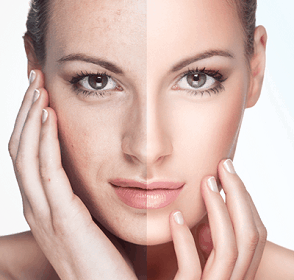 New Fountain of Youth- Phytoceramides